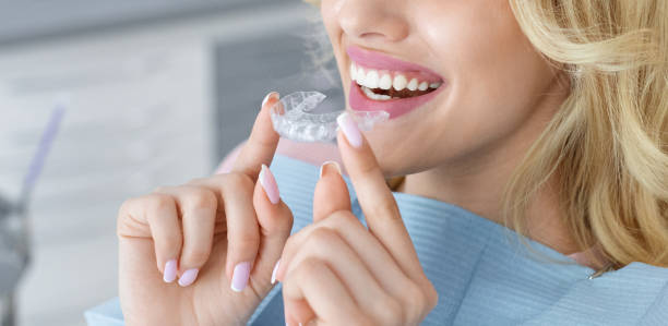 Beneficios de la Ortodoncia transparente