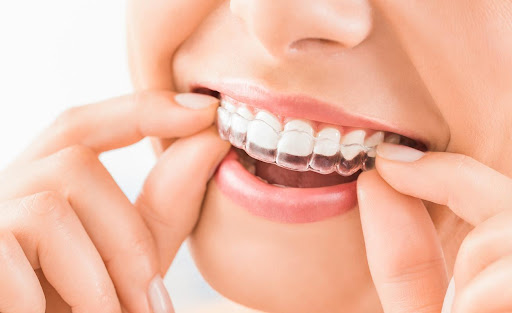 Qué es ortodoncia